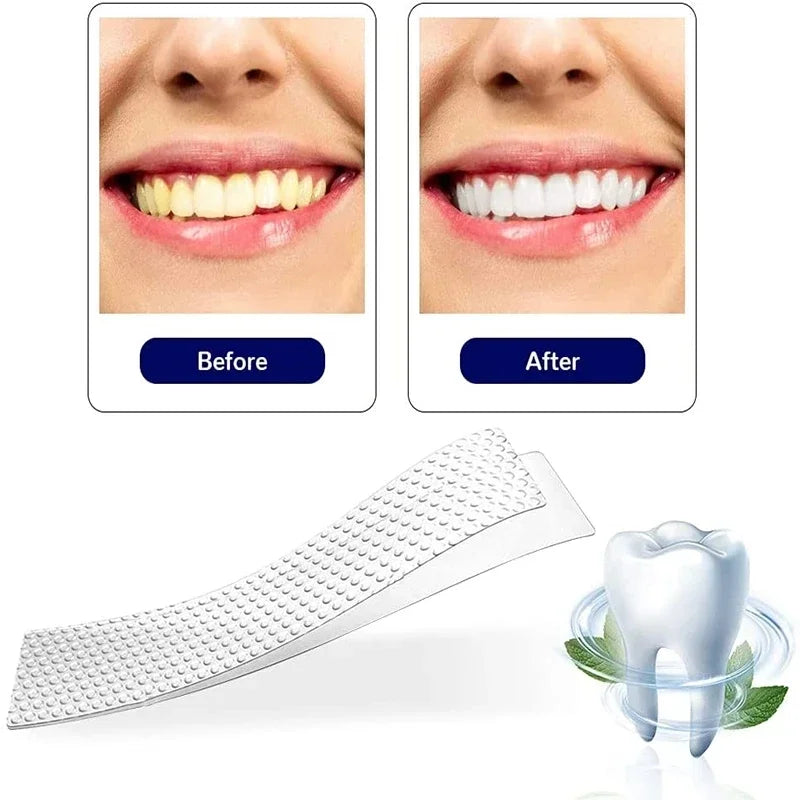 5D Whitening Teeth Stickers